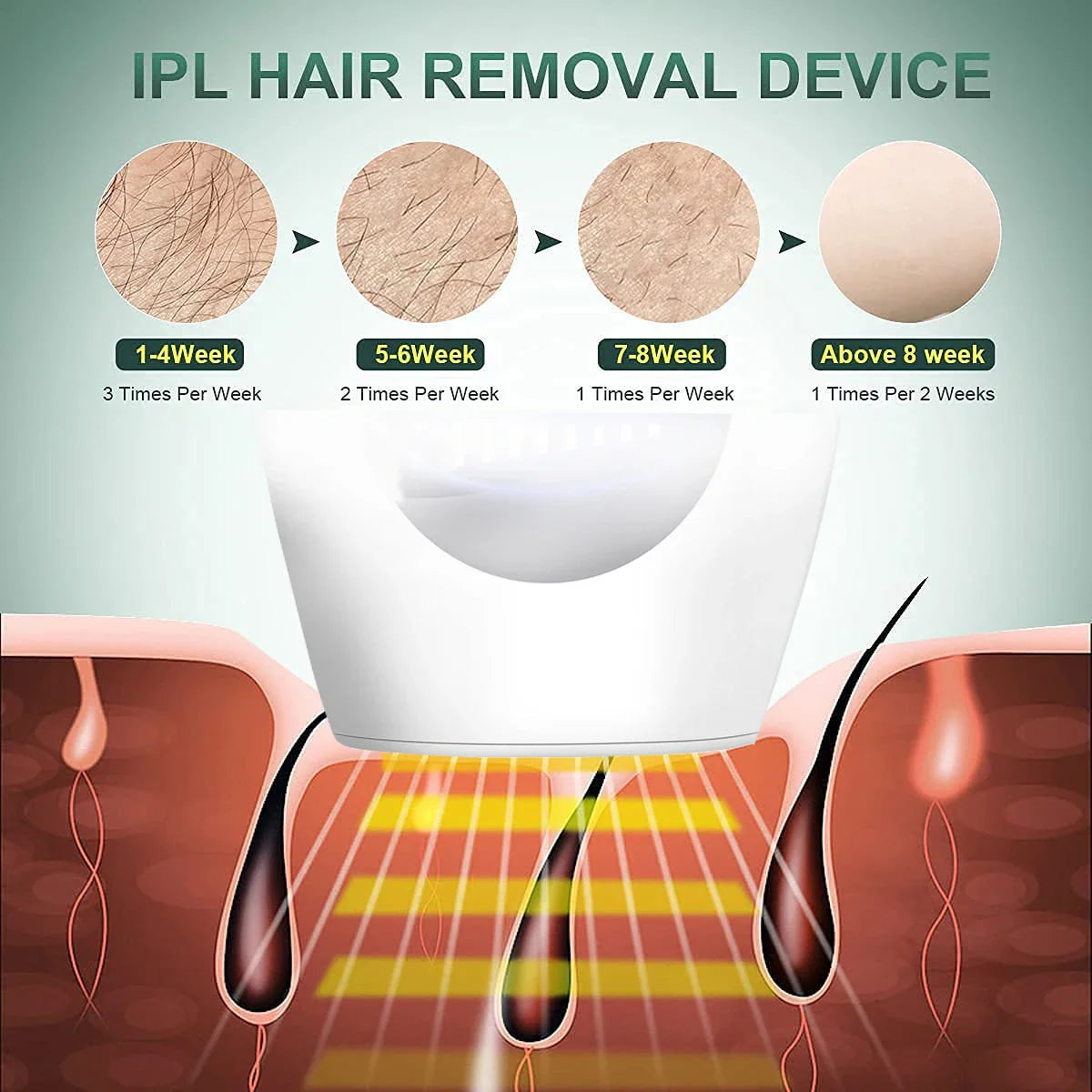 KODO 2024Нова лазерна гаряча продаж Лазерний епілятор Постійний IPL Фотоепілятор Видалення волосся Безболісний електричний епілятор